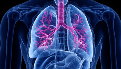 什么是慢性阻塞性肺病 (Chronic Obstructive Pulmonary Disease)，为何与新冠疫情有关？